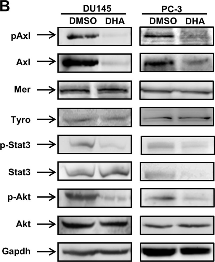 Detection of Human Axl by Western Blot