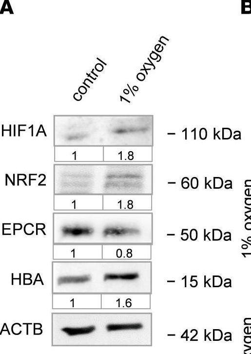 Detection of EPCR by Western Blot