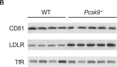 Detection of Mouse LDLR by Western Blot