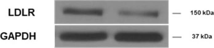 Detection of Mouse LDLR by Western Blot