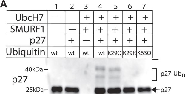 Detection of p27/Kip1 by Western Blot