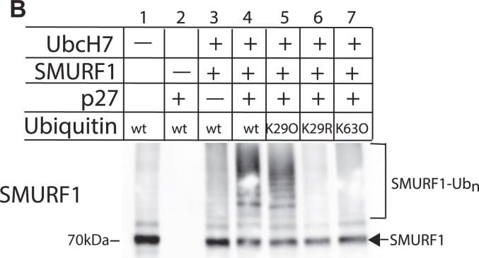 Detection of p27/Kip1 by Western Blot