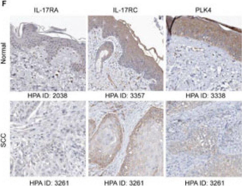 Detection of IL-17RC by Immunohistochemistry