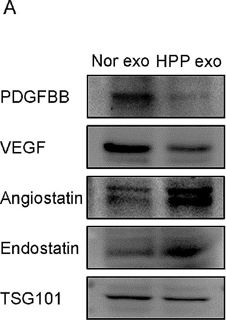 Detection of Angiostatin by Western Blot