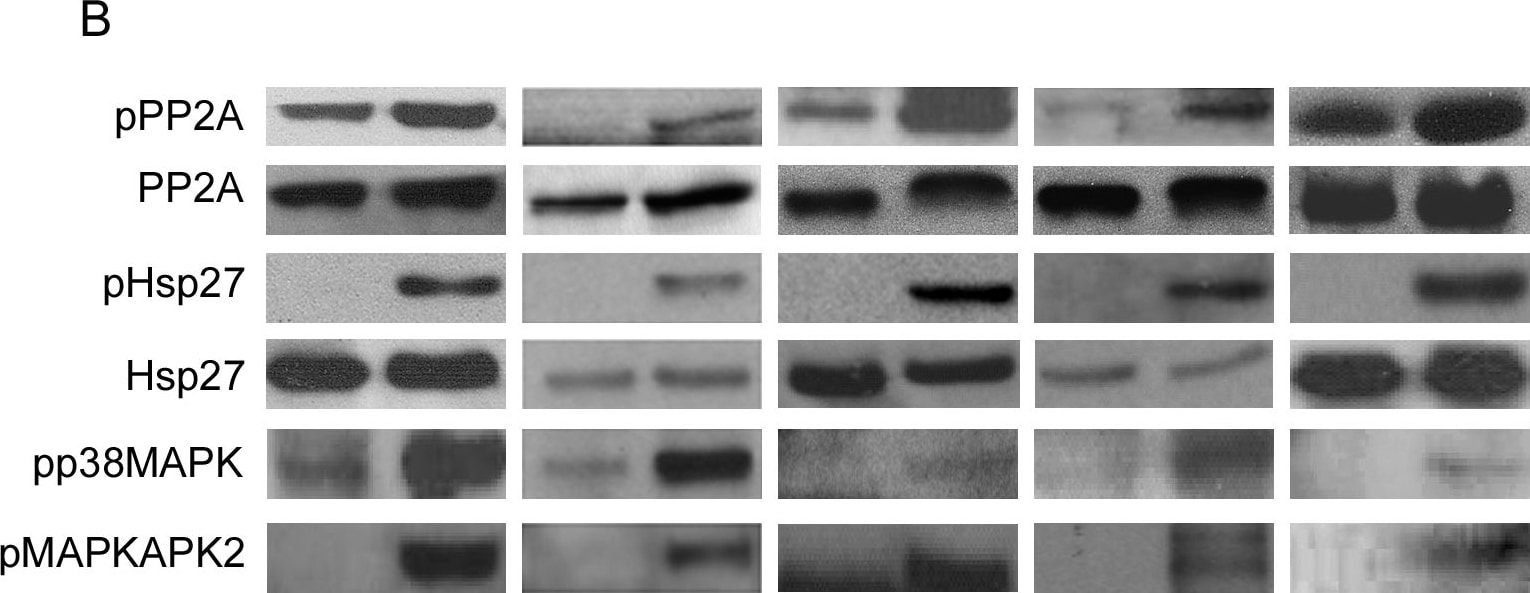 Detection of Human HSP27 by Western Blot