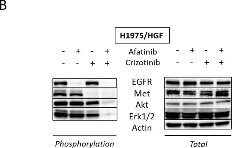 Detection of Human Human EGFR Antibody by Western Blot