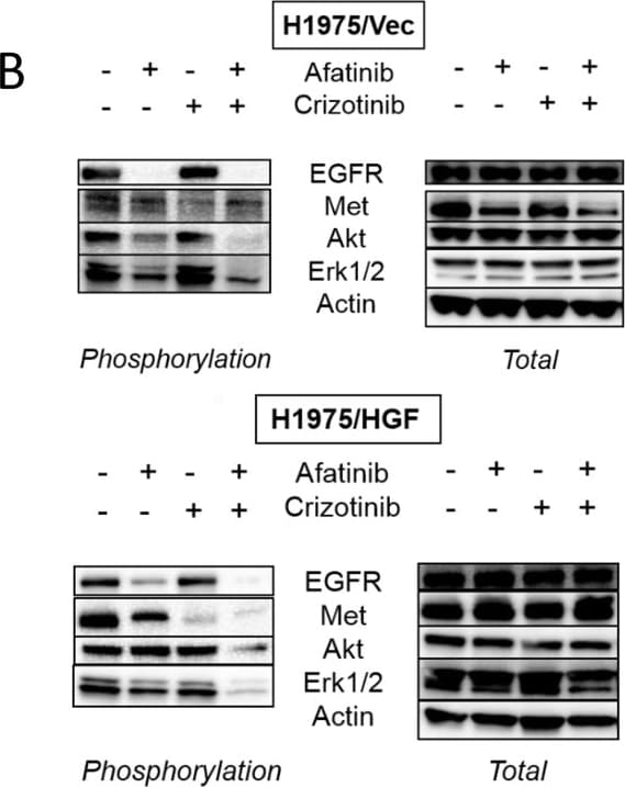Detection of Mouse EGFR by Western Blot