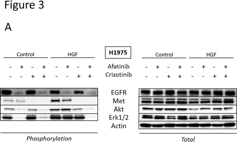 Detection of Human EGFR by Western Blot
