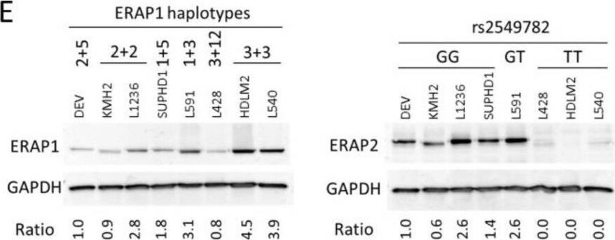 Detection of Aminopeptidase PILS/ARTS1 by Western Blot