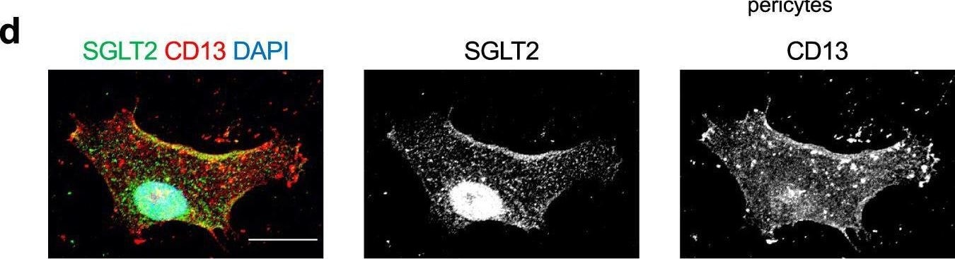 Detection of Aminopeptidase N/CD13 by Immunocytochemistry/ Immunofluorescence