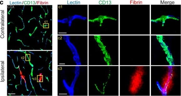 Detection of Aminopeptidase N/CD13 by Immunohistochemistry