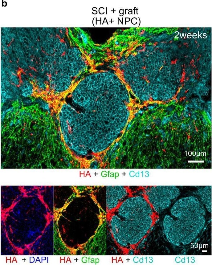 Detection of Aminopeptidase N/CD13 by Immunohistochemistry