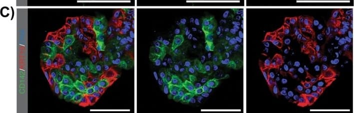 Detection of Coagulation Factor III/Tissue Factor by Immunohistochemistry