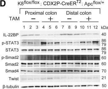 Detection of IL-22BP by Western Blot