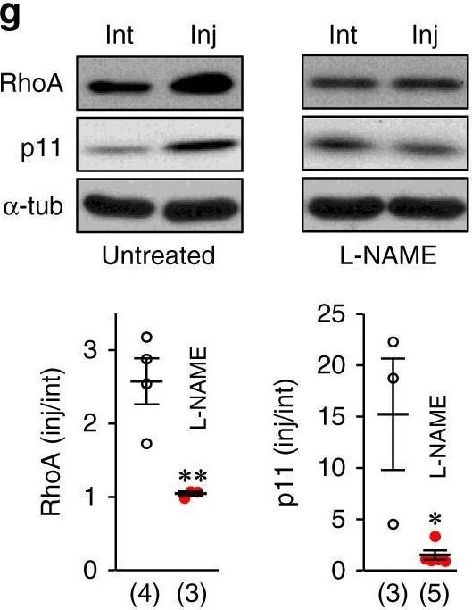 Detection of S100A10 by Western Blot