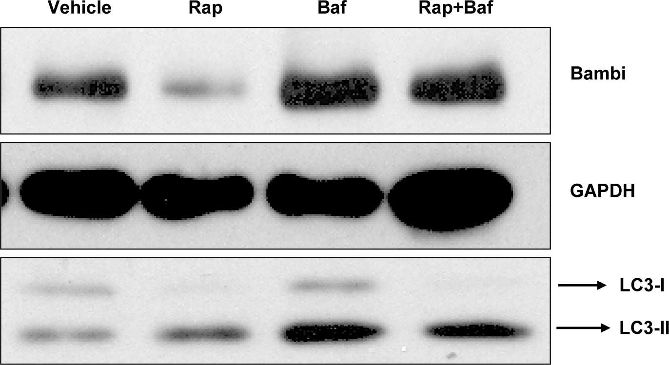 Detection of Human BAMBI/NMA by Western Blot