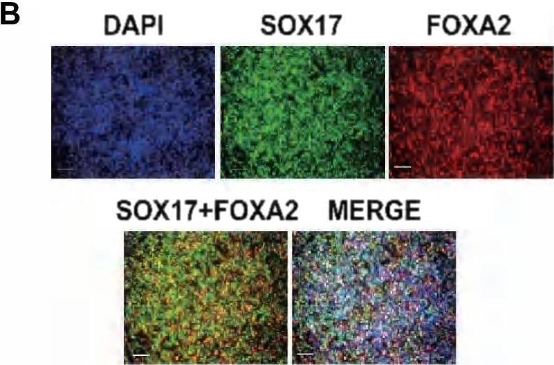 Detection of HNF-3 beta /FoxA2 by Immunocytochemistry/ Immunofluorescence