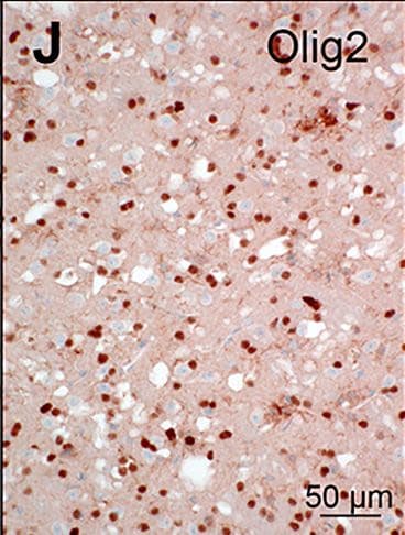 Detection of Mouse Olig2 by Immunocytochemistry/Immunofluorescence