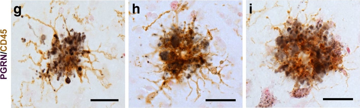 Detection of Human Progranulin/PGRN by Immunohistochemistry