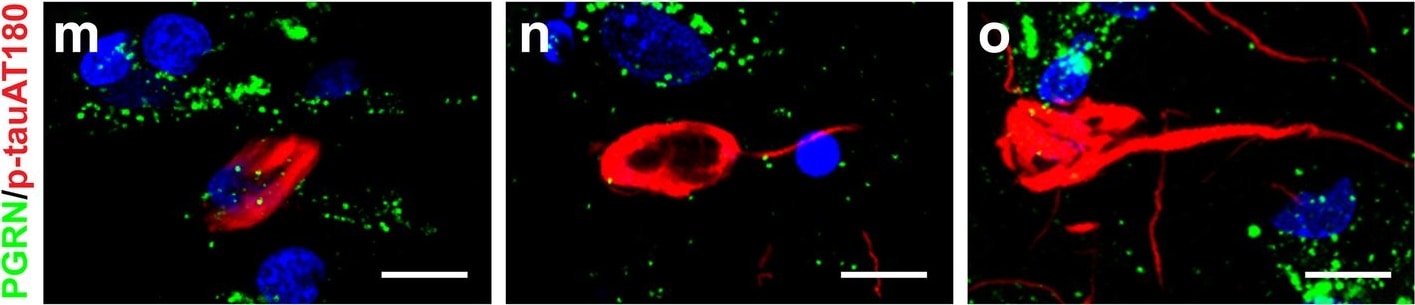 Detection of Human Progranulin/PGRN by Immunocytochemistry/Immunofluorescence