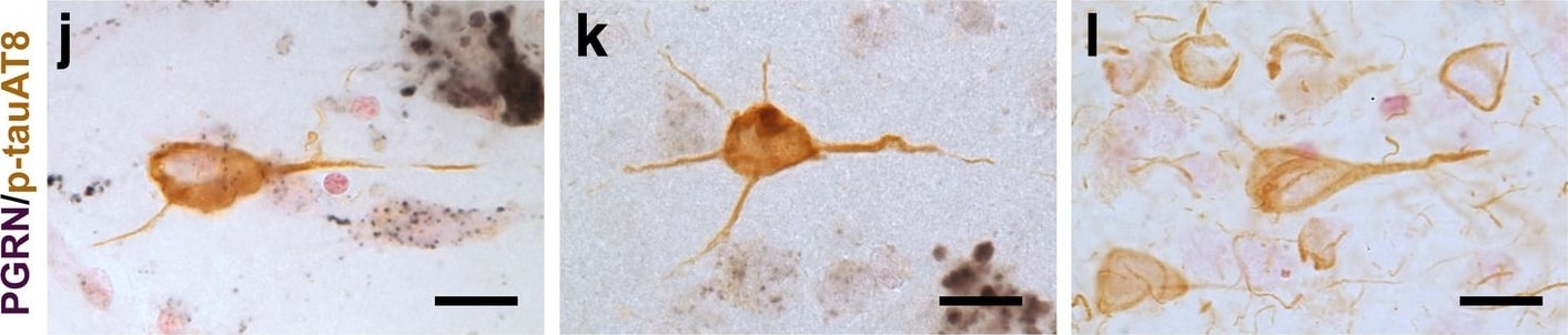 Detection of Human Progranulin/PGRN by Immunohistochemistry