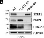 Detection of Human Progranulin/PGRN by Knockout Validated