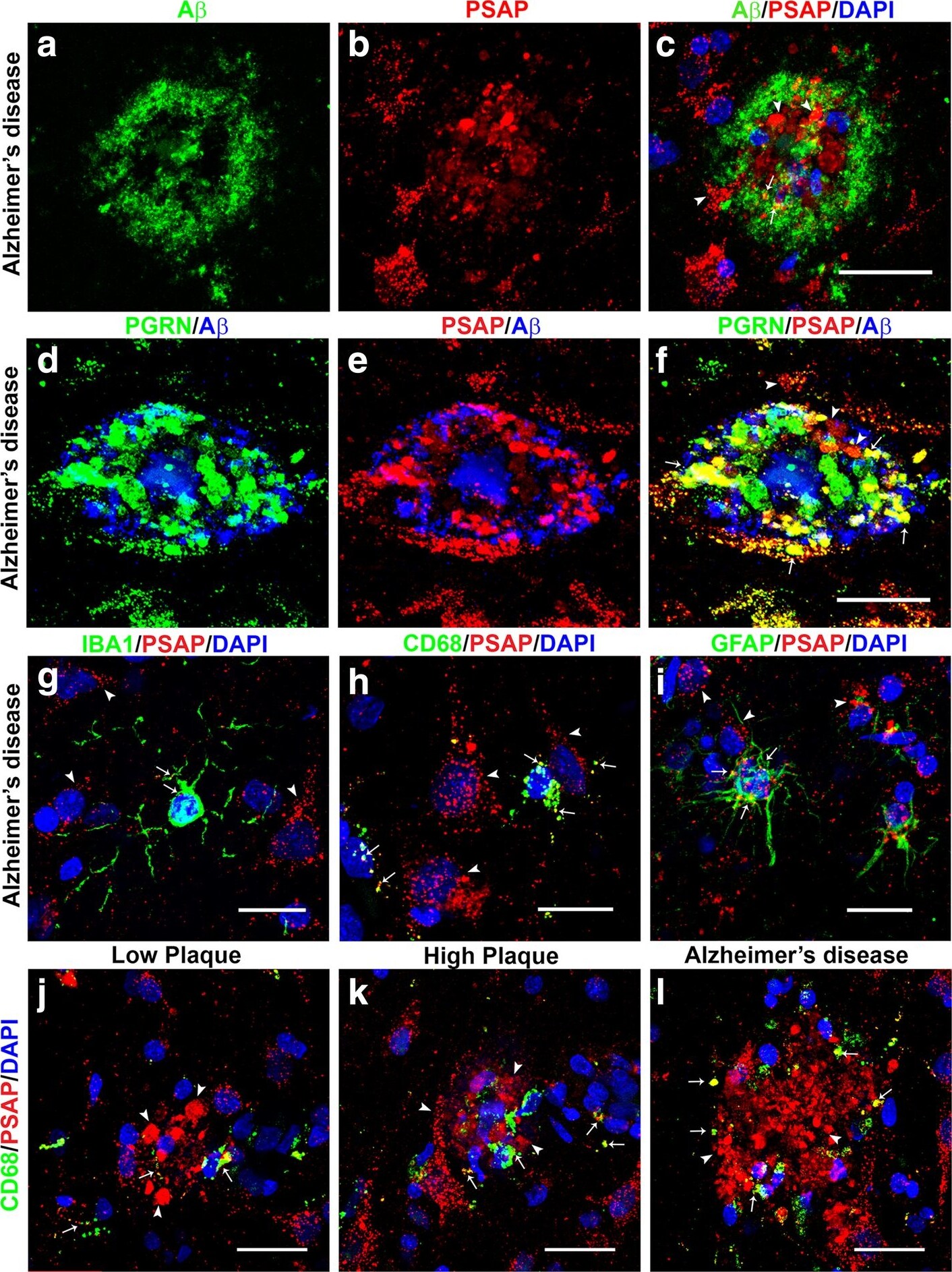 Detection of Human Progranulin/PGRN by Immunocytochemistry/Immunofluorescence