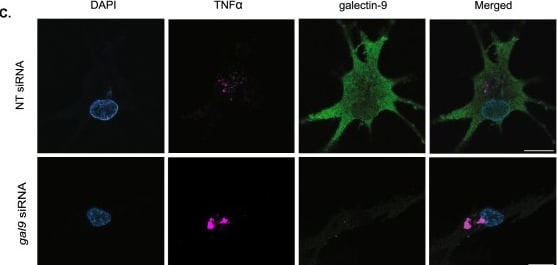 Detection of LILRB4/CD85k/ILT3 by Immunocytochemistry/ Immunofluorescence