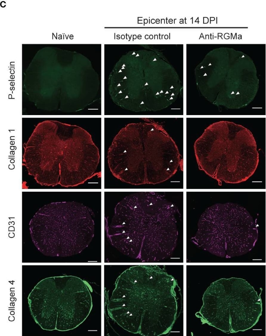 Detection of RGM-A by Immunohistochemistry