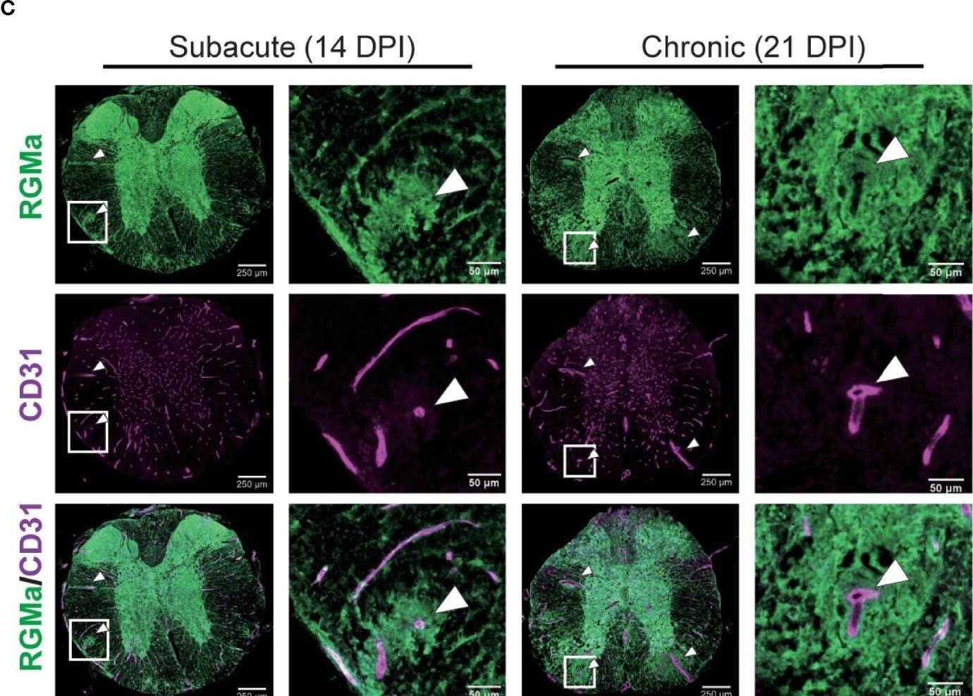 Detection of RGM-A by Immunohistochemistry