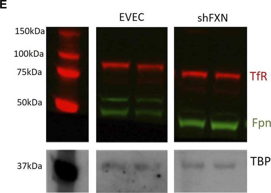 Detection of TfR (Transferrin R) by Western Blot