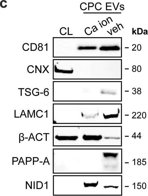 Detection of Human Pappalysin-1/PAPP-A by Western Blot