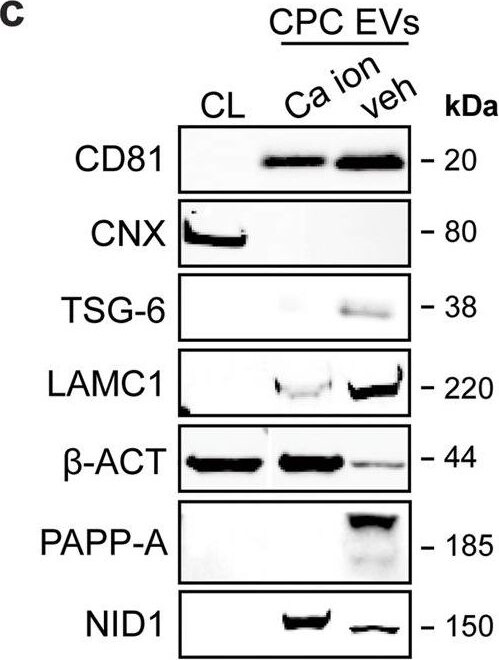 Detection of Human Pappalysin-1/PAPP-A by Western Blot