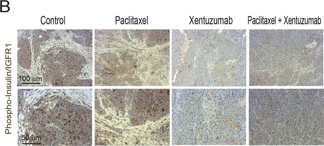 Detection of Human Human Phospho-Insulin R (Y1162/Y1163)/ IGF-I R (Y1135/Y1136) Antibody by Immunohistochemistry