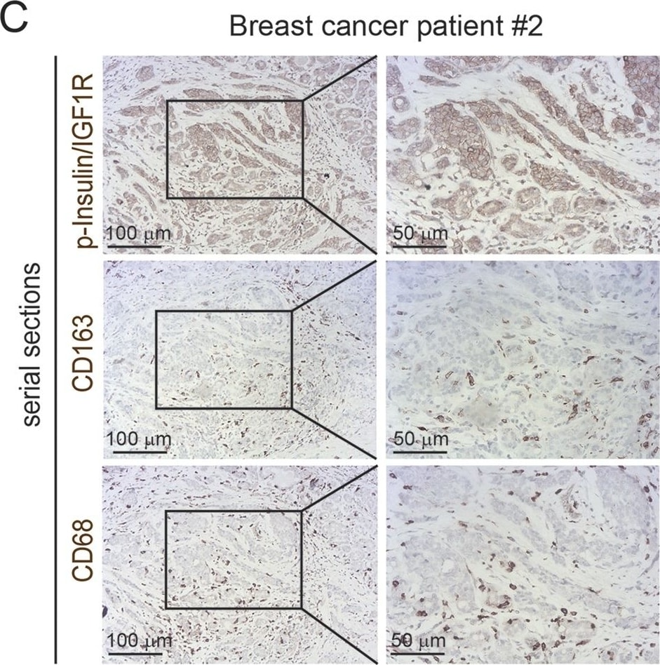 Detection of Human Human Phospho-Insulin R (Y1162/Y1163)/ IGF-I R (Y1135/Y1136) Antibody by Immunohistochemistry