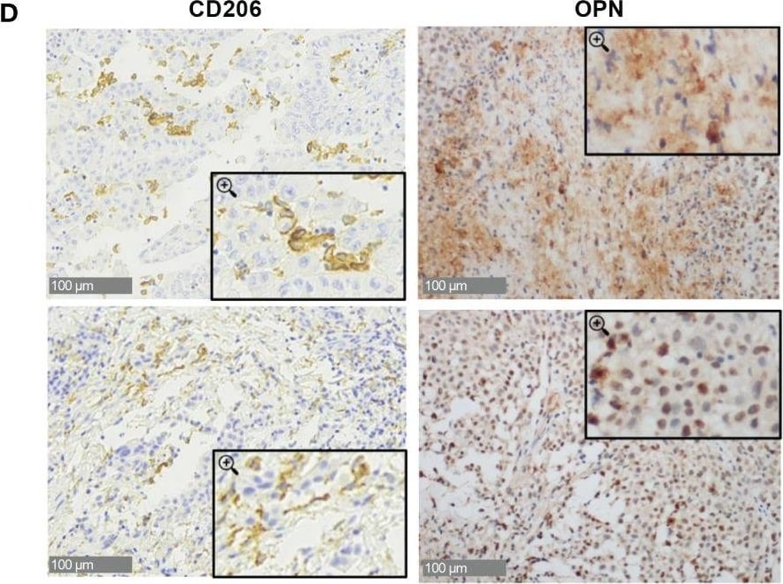 Detection of Human MMR/CD206/Mannose Receptor by Immunohistochemistry-Paraffin