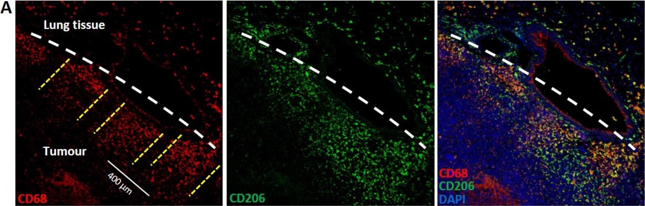 Detection of Mouse Mouse MMR/CD206 Antibody by Immunohistochemistry