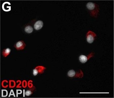 Detection of Mouse MMR/CD206/Mannose Receptor by Immunocytochemistry/Immunofluorescence