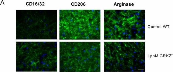 Mouse MMR/CD206 Antibody AF2535: R&D Systems