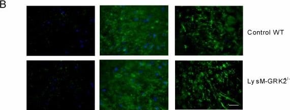 Detection of Mouse MMR/CD206/Mannose Receptor by Immunocytochemistry/Immunofluorescence