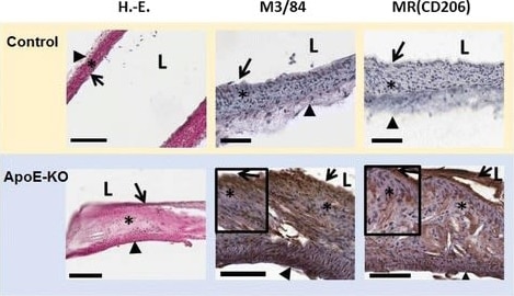Detection of Mouse MMR/CD206/Mannose Receptor by Immunohistochemistry