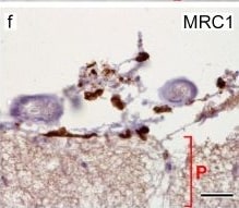 Detection of Human MMR/CD206/Mannose Receptor by Immunocytochemistry/Immunofluorescence