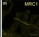 Detection of Human MMR/CD206/Mannose Receptor by Immunocytochemistry/Immunofluorescence