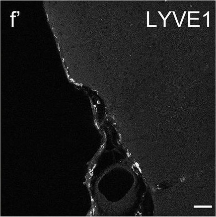 Detection of Mouse MMR/CD206/Mannose Receptor by Immunocytochemistry/Immunofluorescence