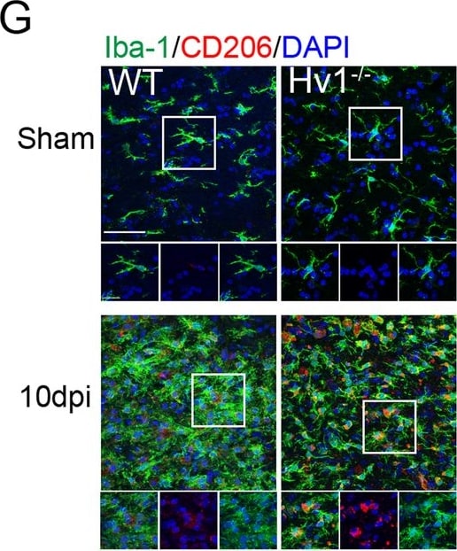 Mouse MMR/CD206 Antibody AF2535: R&D Systems
