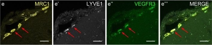 Detection of Mouse MMR/CD206/Mannose Receptor by Immunocytochemistry/Immunofluorescence