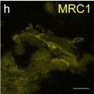 Detection of Human MMR/CD206/Mannose Receptor by Immunocytochemistry/Immunofluorescence