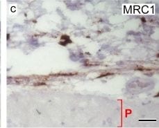 Detection of Human MMR/CD206/Mannose Receptor by Immunocytochemistry/Immunofluorescence