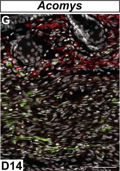 Detection of Mouse MMR/CD206/Mannose Receptor by Immunocytochemistry/Immunofluorescence
