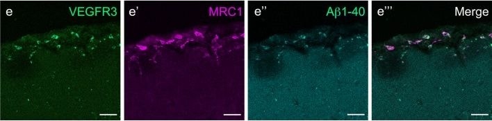 Detection of Mouse MMR/CD206/Mannose Receptor by Immunocytochemistry/Immunofluorescence